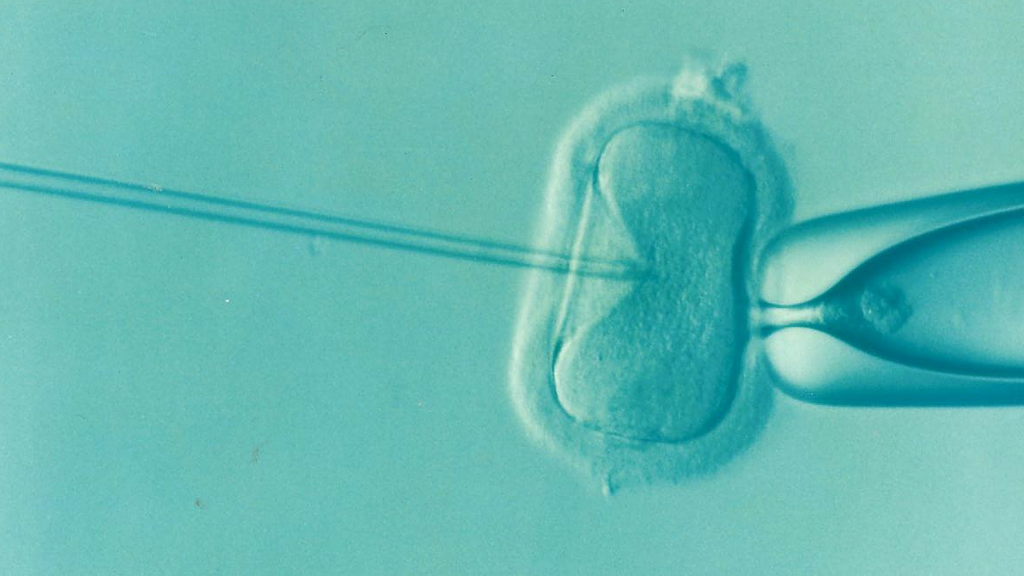 fecondazione in vitro